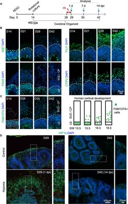 Distinct Vulnerability and Resilience of Human Neuroprogenitor Subtypes in Cerebral Organoid Model of Prenatal Hypoxic Injury